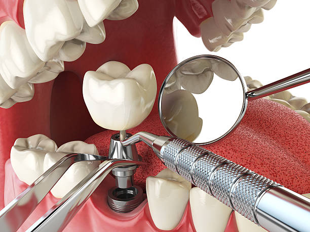 Best Emergency Tooth Extraction in Tarpey Village, CA